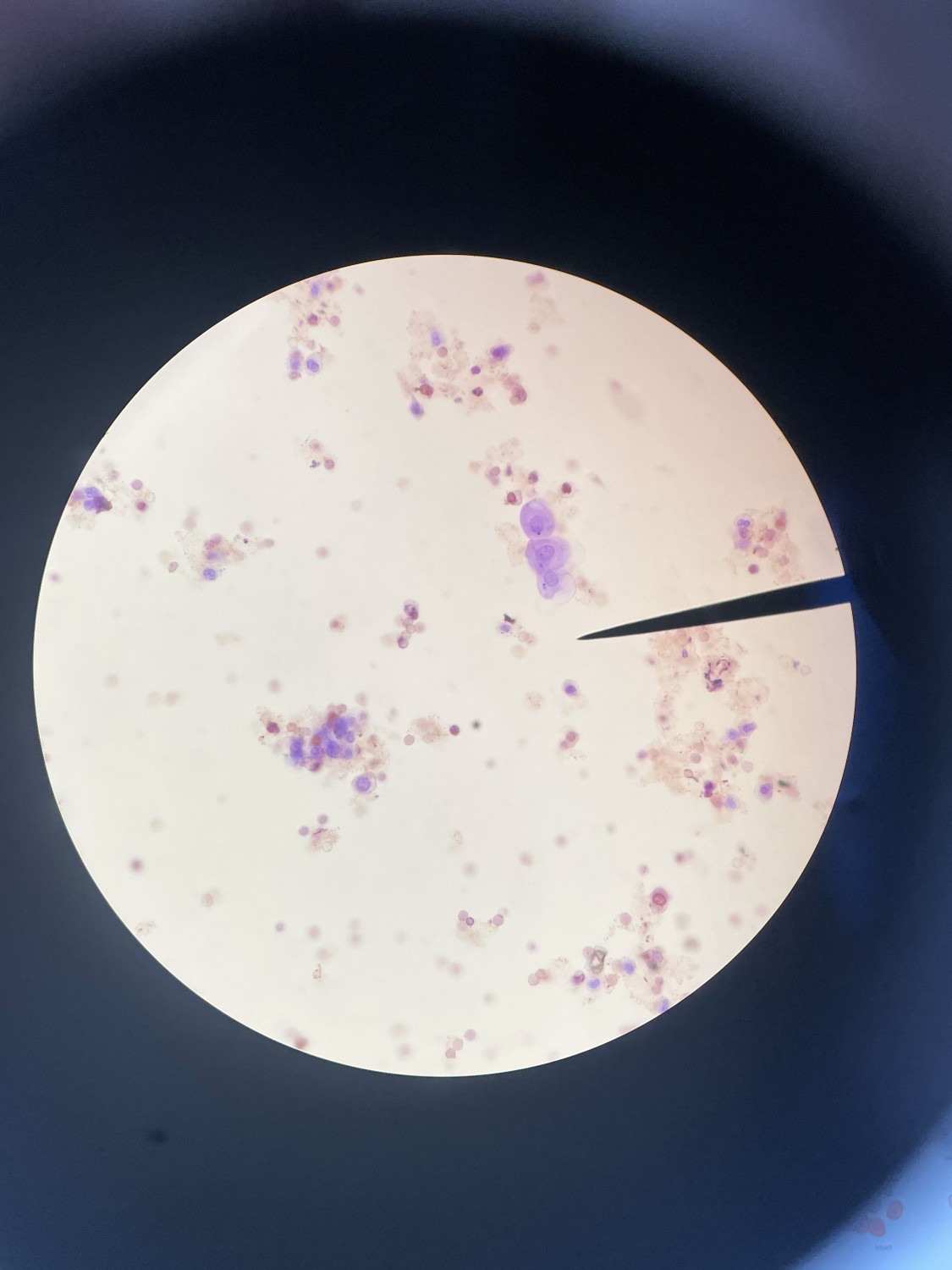 Cytologies